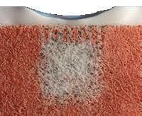Tissue remodelling