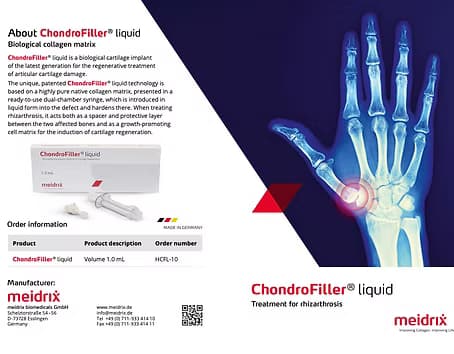 ChondroFiller for thumb arthritis (Rhizarthrosis) brochure cover