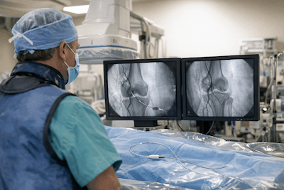 Fluoroscopy-guided catheter procedure